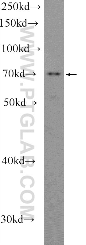 Western Blot (WB) analysis of Jurkat cells using NO66/C14orf169 Polyclonal antibody (22842-1-AP)