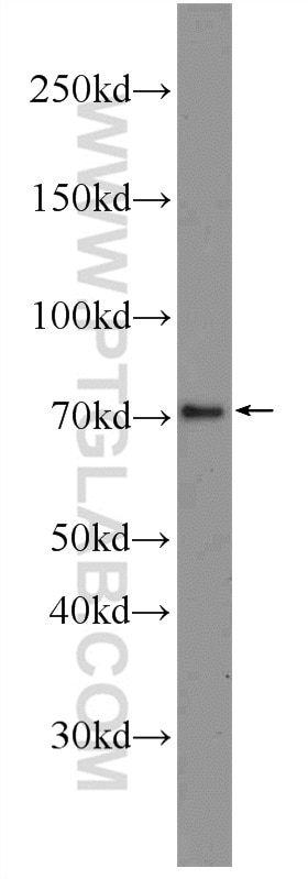 Western Blot (WB) analysis of A431 cells using NO66/C14orf169 Polyclonal antibody (22842-1-AP)