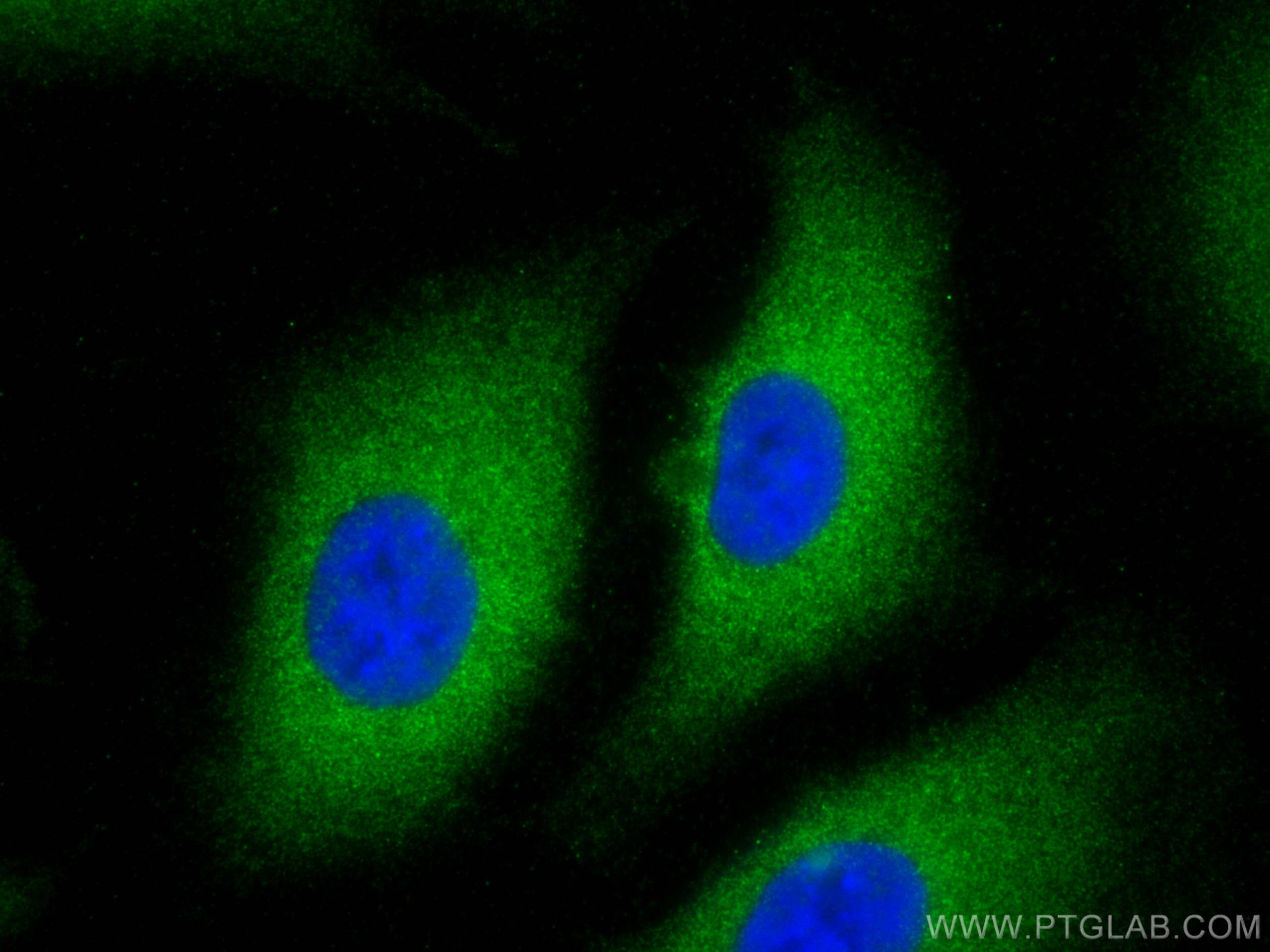 Immunofluorescence (IF) / fluorescent staining of A549 cells using NOB1 Polyclonal antibody (10091-2-AP)