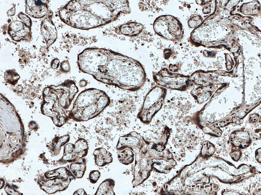 IHC staining of human placenta using 10091-2-AP