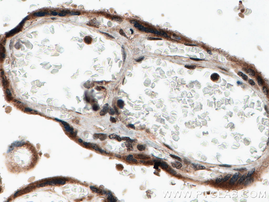 Immunohistochemistry (IHC) staining of human placenta tissue using NOB1 Polyclonal antibody (10091-2-AP)