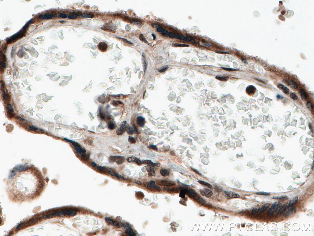 IHC staining of human placenta using 10091-2-AP