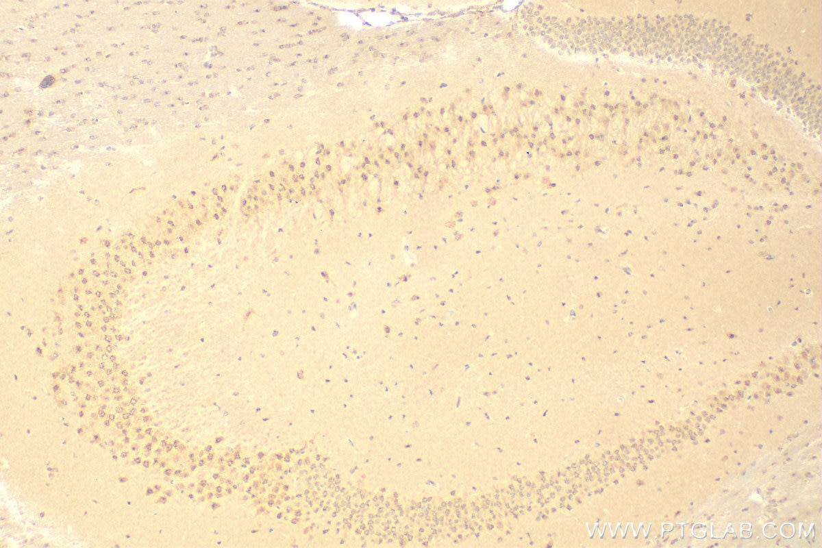 Immunohistochemistry (IHC) staining of mouse brain tissue using NOB1 Polyclonal antibody (10091-2-AP)