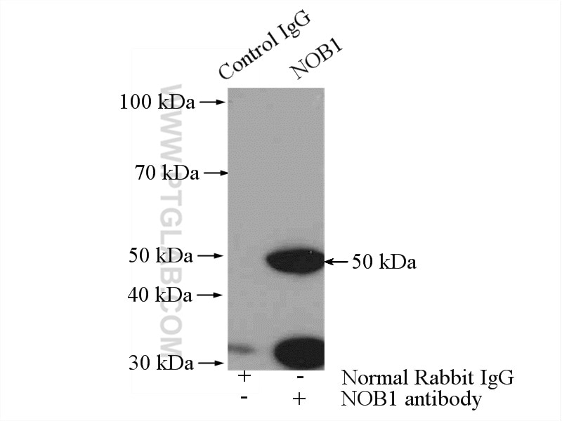 Immunoprecipitation (IP) experiment of HepG2 cells using NOB1 Polyclonal antibody (10091-2-AP)