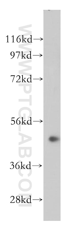 Western Blot (WB) analysis of Jurkat cells using NOB1 Polyclonal antibody (14456-1-AP)