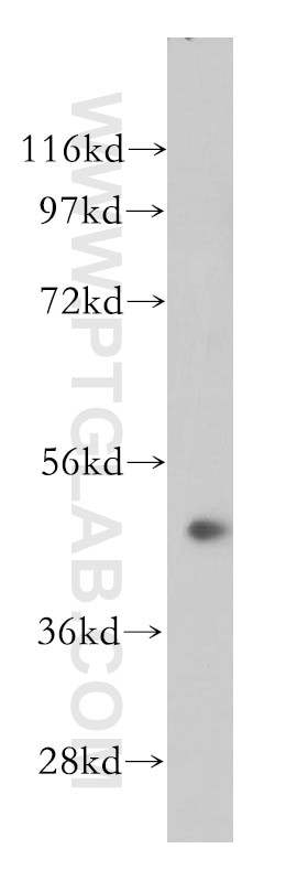 WB analysis of Jurkat using 14456-1-AP