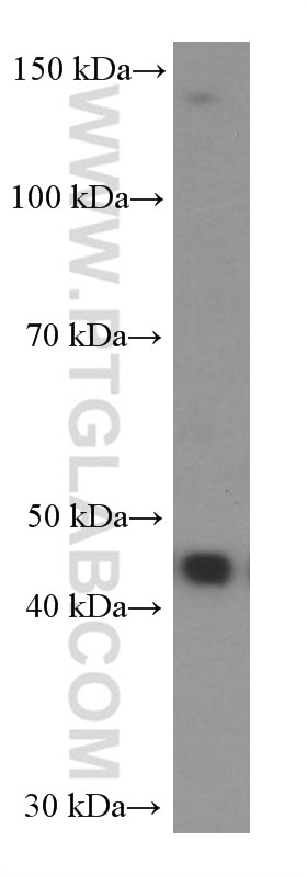 Western Blot (WB) analysis of Jurkat cells using NOB1 Monoclonal antibody (66048-1-Ig)