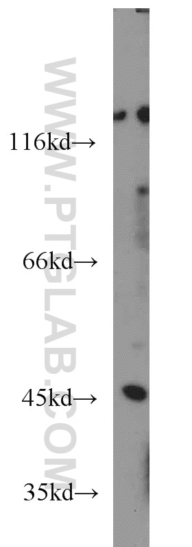 Western Blot (WB) analysis of human placenta tissue using NOB1 Monoclonal antibody (66048-1-Ig)