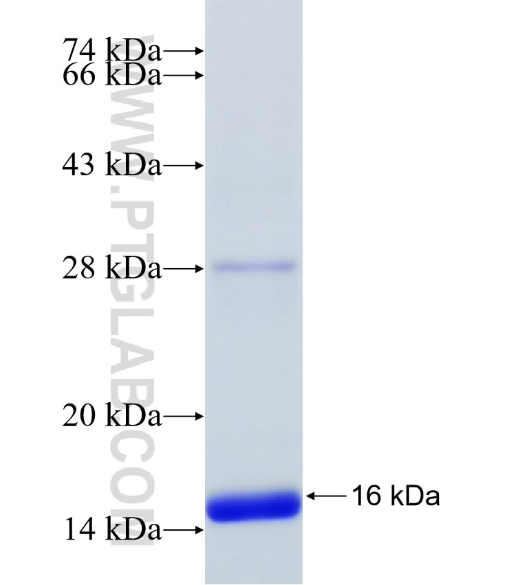 NOBOX fusion protein Ag35180 SDS-PAGE NOBOX fusion protein Ag35180 SDS-PAGE