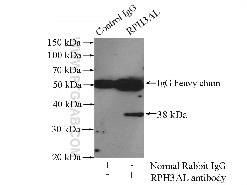 Immunoprecipitation (IP) experiment of HepG2 cells using RPH3AL Polyclonal antibody (15297-1-AP)