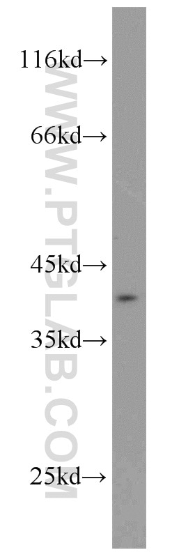 Western Blot (WB) analysis of L02 cells using RPH3AL Polyclonal antibody (15297-1-AP)