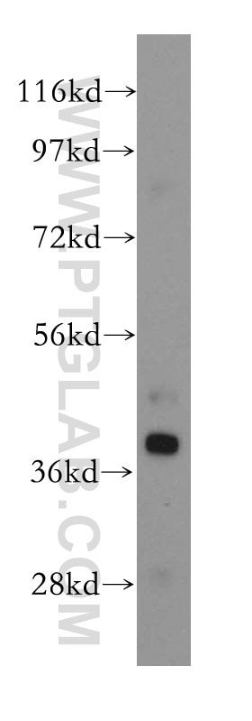 Western Blot (WB) analysis of human liver tissue using RPH3AL Polyclonal antibody (15297-1-AP)