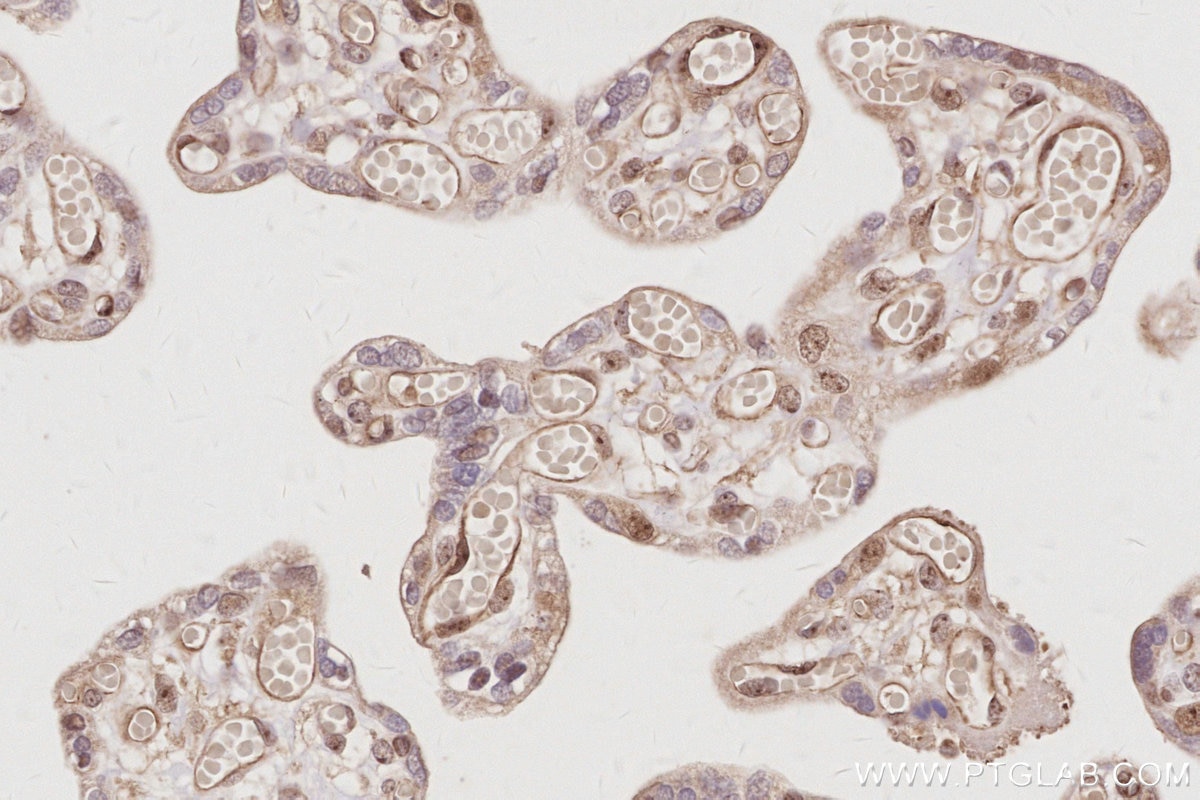 IHC staining of human placenta using 28509-1-AP Immunohistochemistry (IHC) staining of human placenta tissue using NOC2L Polyclonal antibody (28509-1-AP)