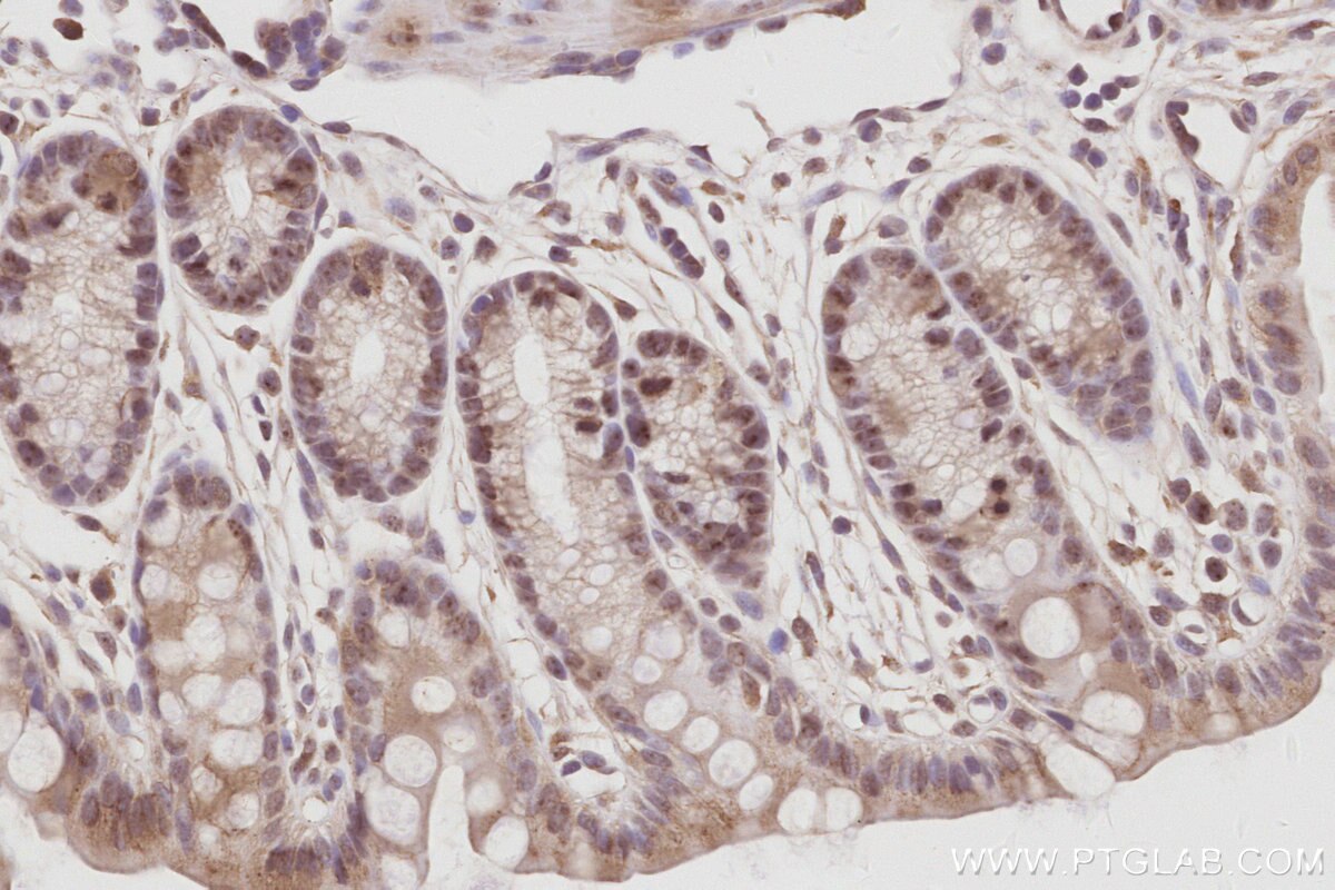 IHC staining of mouse colon using 28509-1-AP Immunohistochemistry (IHC) staining of mouse colon tissue using NOC2L Polyclonal antibody (28509-1-AP)