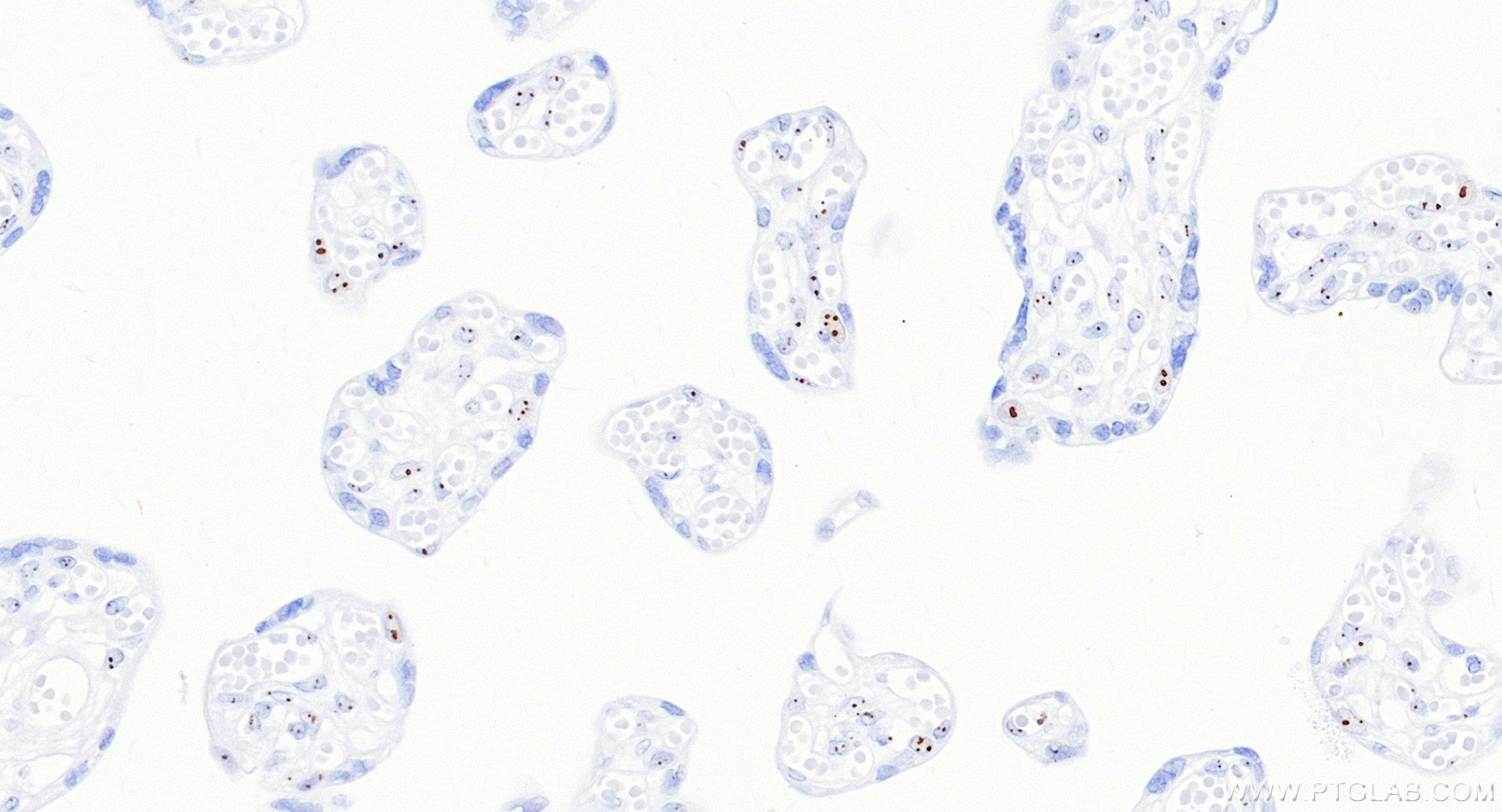 IHC staining of human placenta using 88267-1-RR Immunohistochemistry (IHC) staining of human placenta tissue using NOC2L Recombinant monoclonal antibody (88267-1-RR)