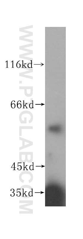 Western Blot (WB) analysis of Jurkat cells using NOC4L Polyclonal antibody (17025-1-AP)