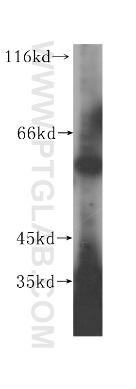 Western Blot (WB) analysis of HeLa cells using NOC4L Polyclonal antibody (17025-1-AP)