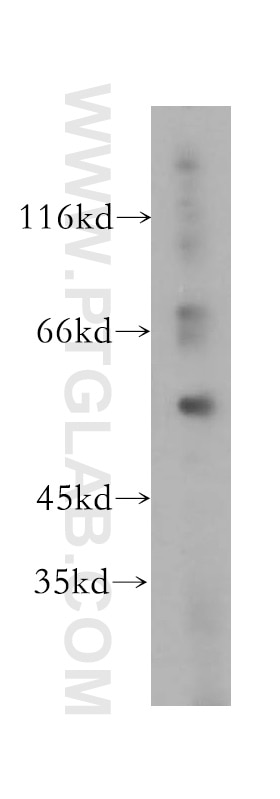 Western Blot (WB) analysis of HeLa cells using NOC4L Polyclonal antibody (17025-1-AP)