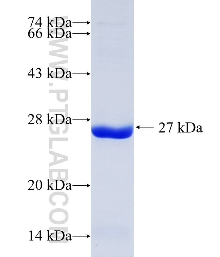 NOD1 fusion protein Ag31831 SDS-PAGE NOD1 fusion protein Ag31831 SDS-PAGE