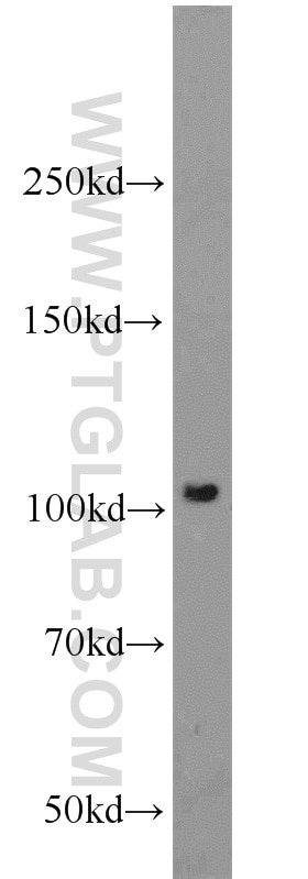 NOD2 Polyclonal antibody