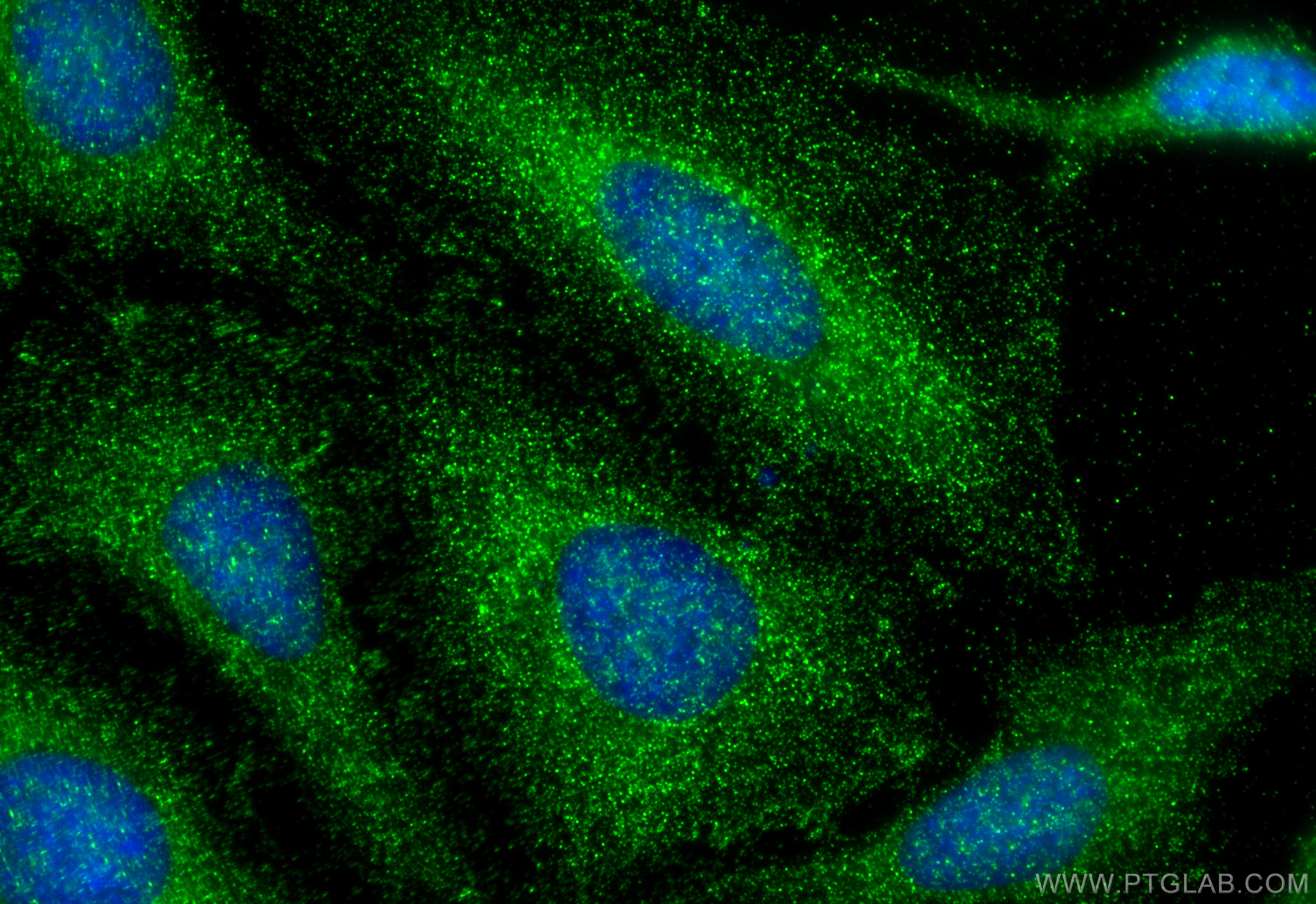 Immunofluorescence (IF) / fluorescent staining of HeLa cells using NOD2 Polyclonal antibody (30628-1-AP)