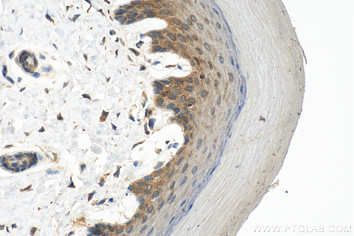 Immunohistochemistry (IHC) staining of mouse skin tissue using NOD2 Polyclonal antibody (30628-1-AP)