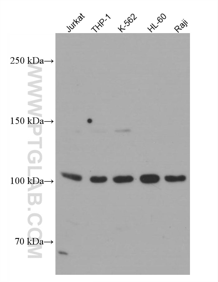 Western Blot (WB) analysis of various lysates using NOD2 Monoclonal antibody (66710-1-Ig)