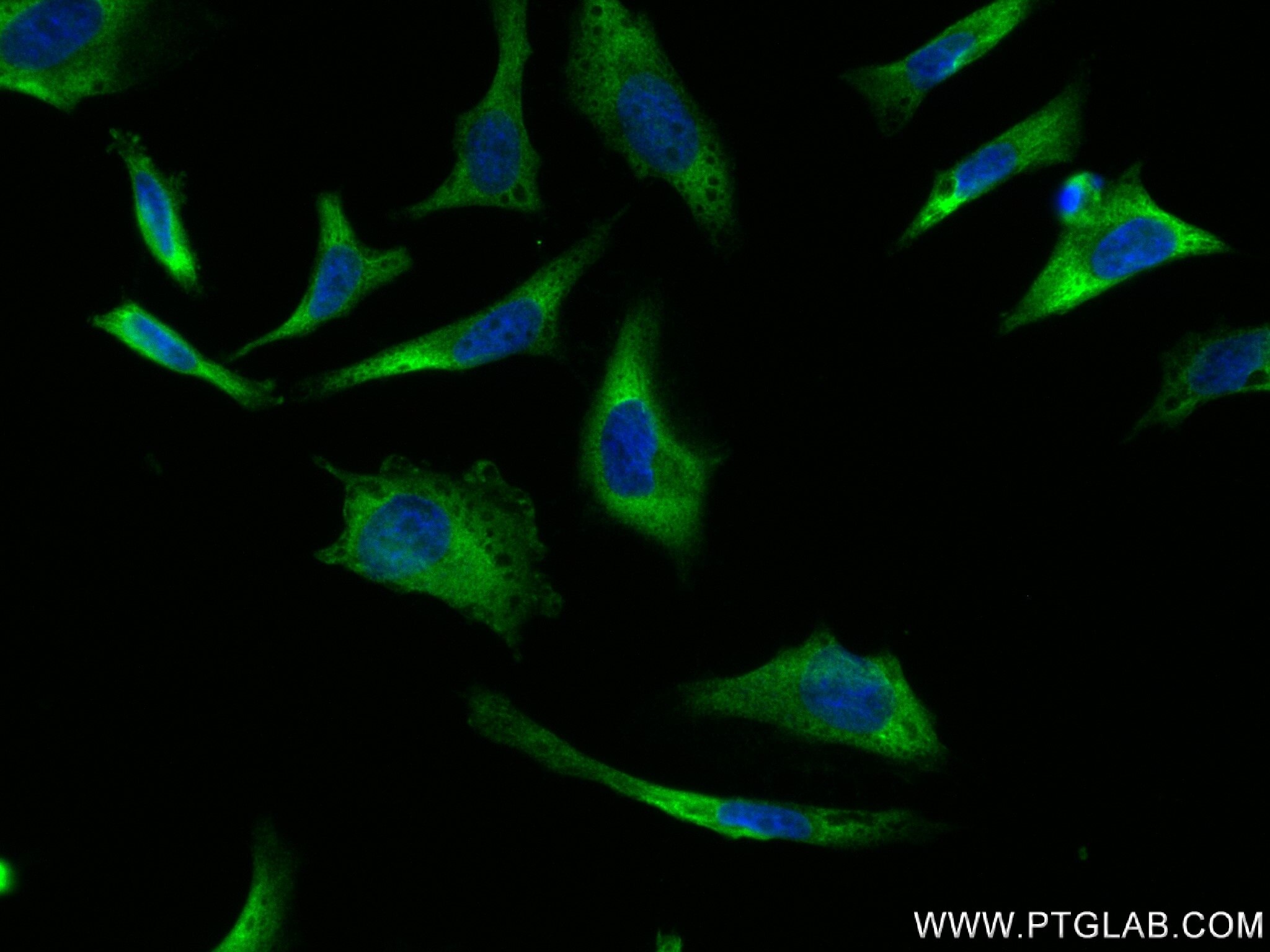 Immunofluorescence (IF) / fluorescent staining of HeLa cells using NOD2 Recombinant antibody (83281-3-RR)