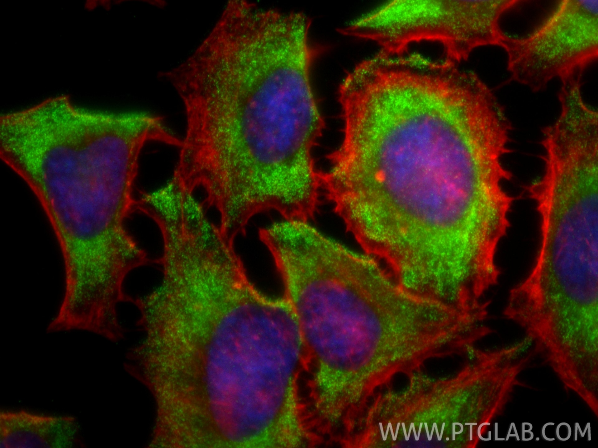 Immunofluorescence (IF) / fluorescent staining of HeLa cells using NOD2 Recombinant antibody (83281-3-RR)