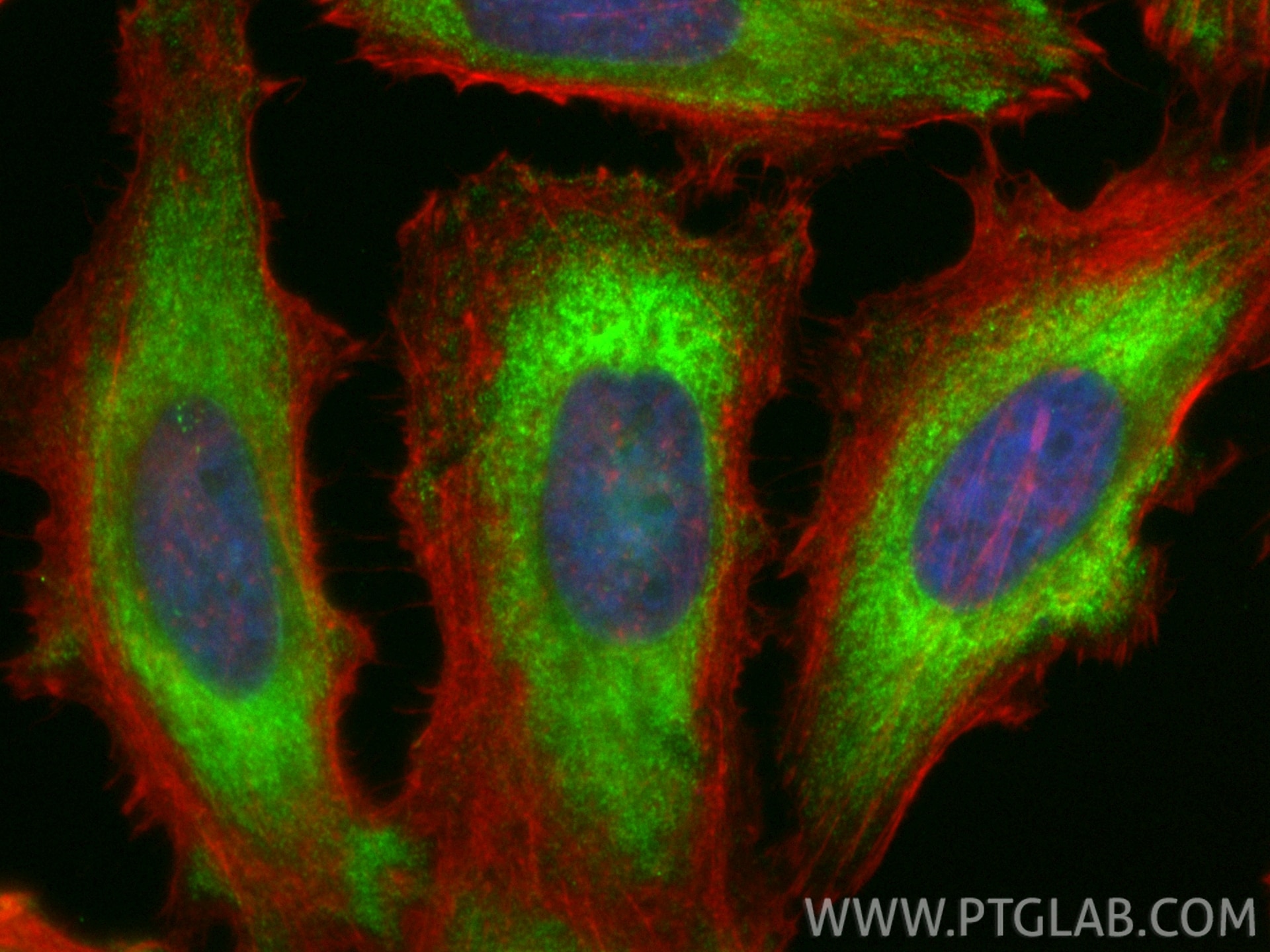 Immunofluorescence (IF) / fluorescent staining of HeLa cells using CoraLite® Plus 488-conjugated NOD2 Recombinant ant (CL488-83281-3)
