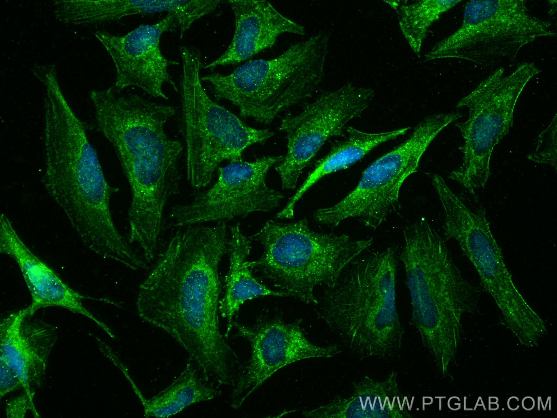 Immunofluorescence (IF) / fluorescent staining of HeLa cells using NODAL Polyclonal antibody (27430-1-AP)