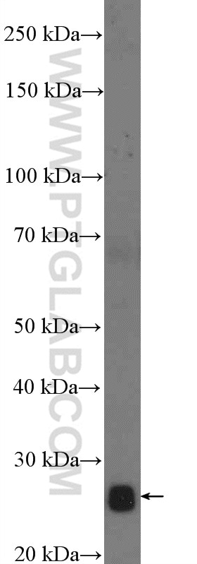 WB analysis of HeLa using 14772-1-AP