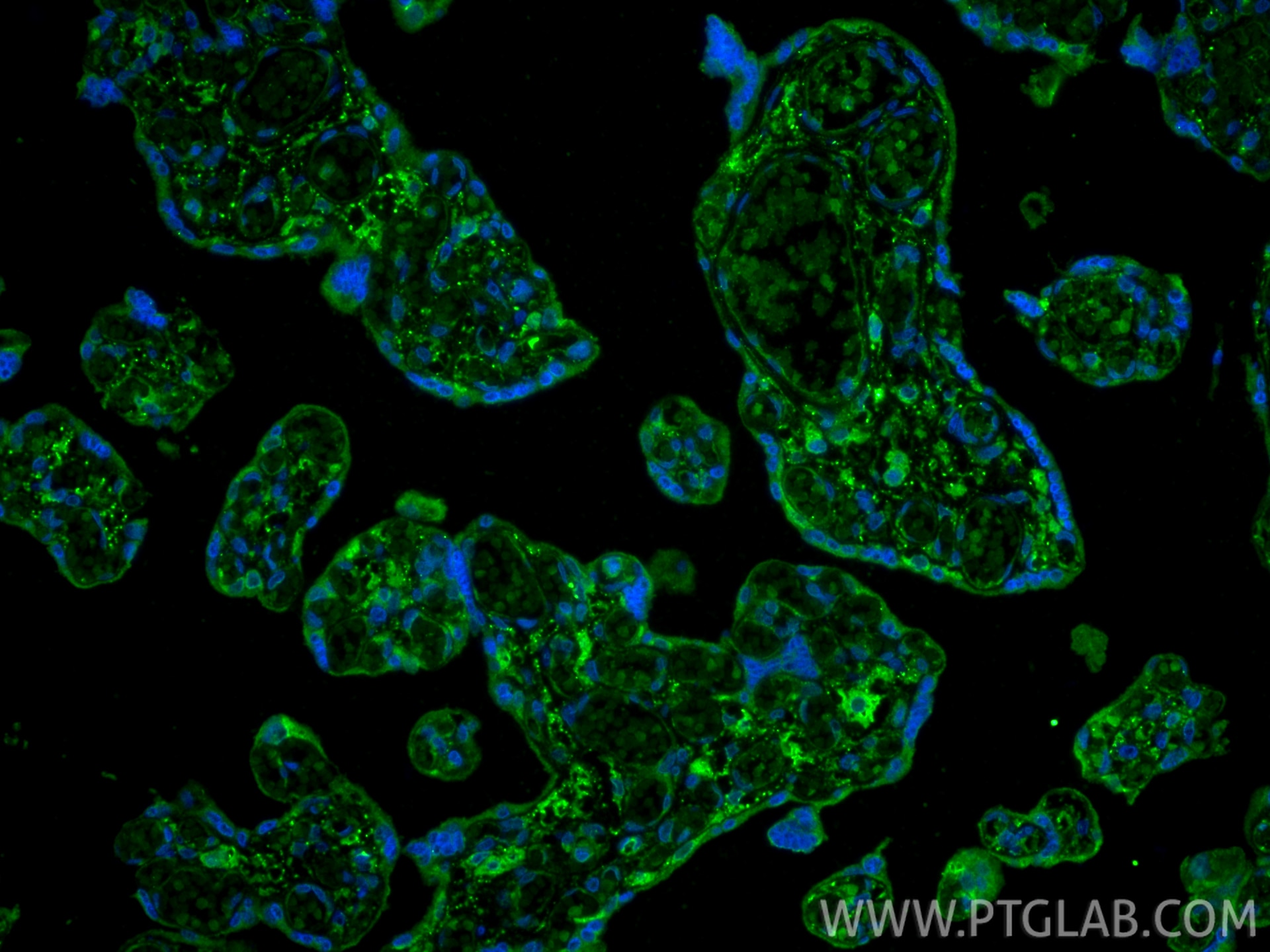 Immunofluorescence (IF) / fluorescent staining of human placenta tissue using Noggin Polyclonal antibody (30023-1-AP)