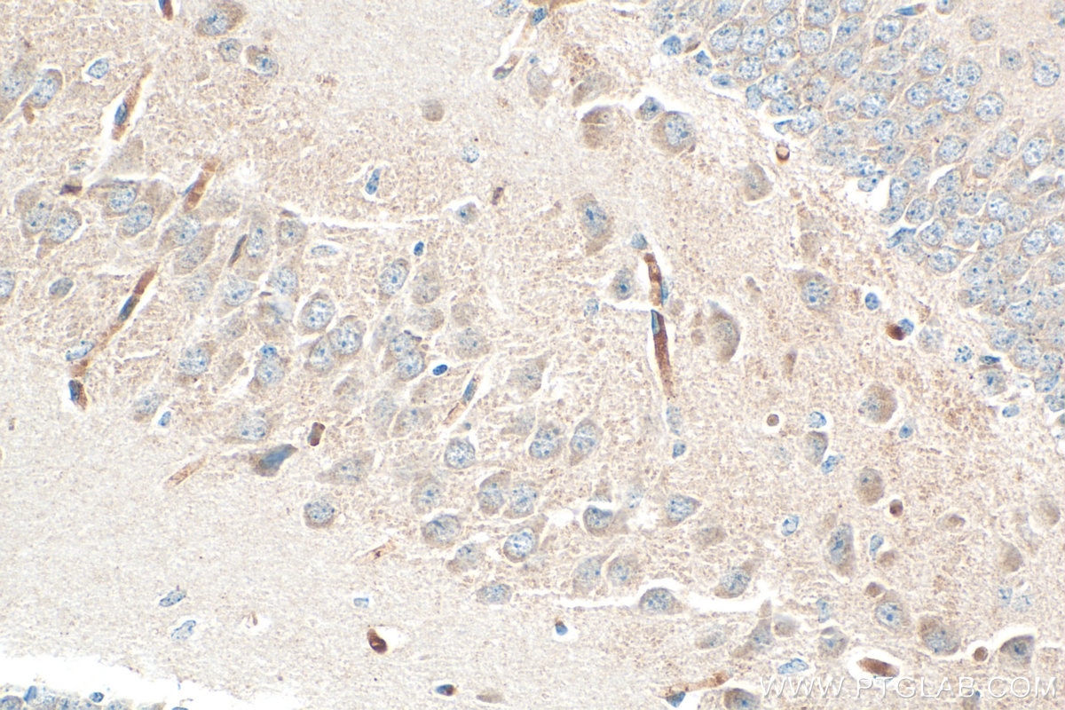 Immunohistochemistry (IHC) staining of mouse brain tissue using Noggin Polyclonal antibody (30023-1-AP)