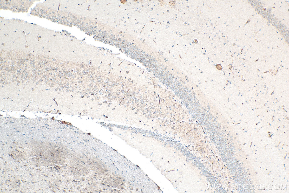Immunohistochemistry (IHC) staining of mouse brain tissue using Noggin Polyclonal antibody (30023-1-AP)