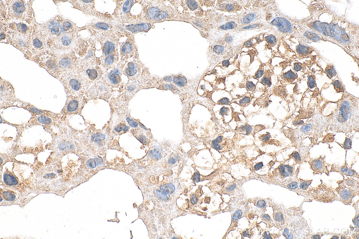 Immunohistochemical analysis of paraffin-embedded mouse placenta tissue slide using 30023-1-AP (Noggin antibody) at dilution of 1:200 (under 40x lens). Heat mediated antigen retrieval with Tris-EDTA buffer (pH 9.0). Immunohistochemistry (IHC) staining of mouse placenta tissue using Noggin Polyclonal antibody (30023-1-AP)