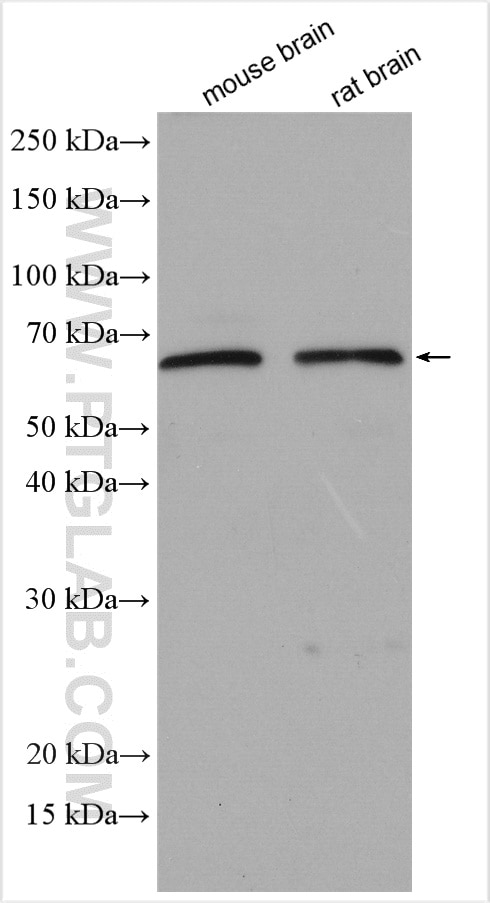 Western Blot (WB) analysis of various lysates using Noggin Polyclonal antibody (30023-1-AP)