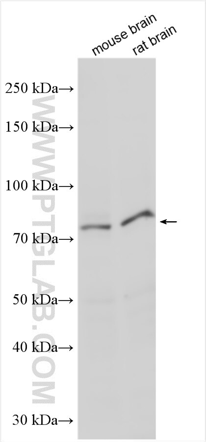 Western Blot (WB) analysis of various lysates using NOL11 Polyclonal antibody (17613-1-AP)