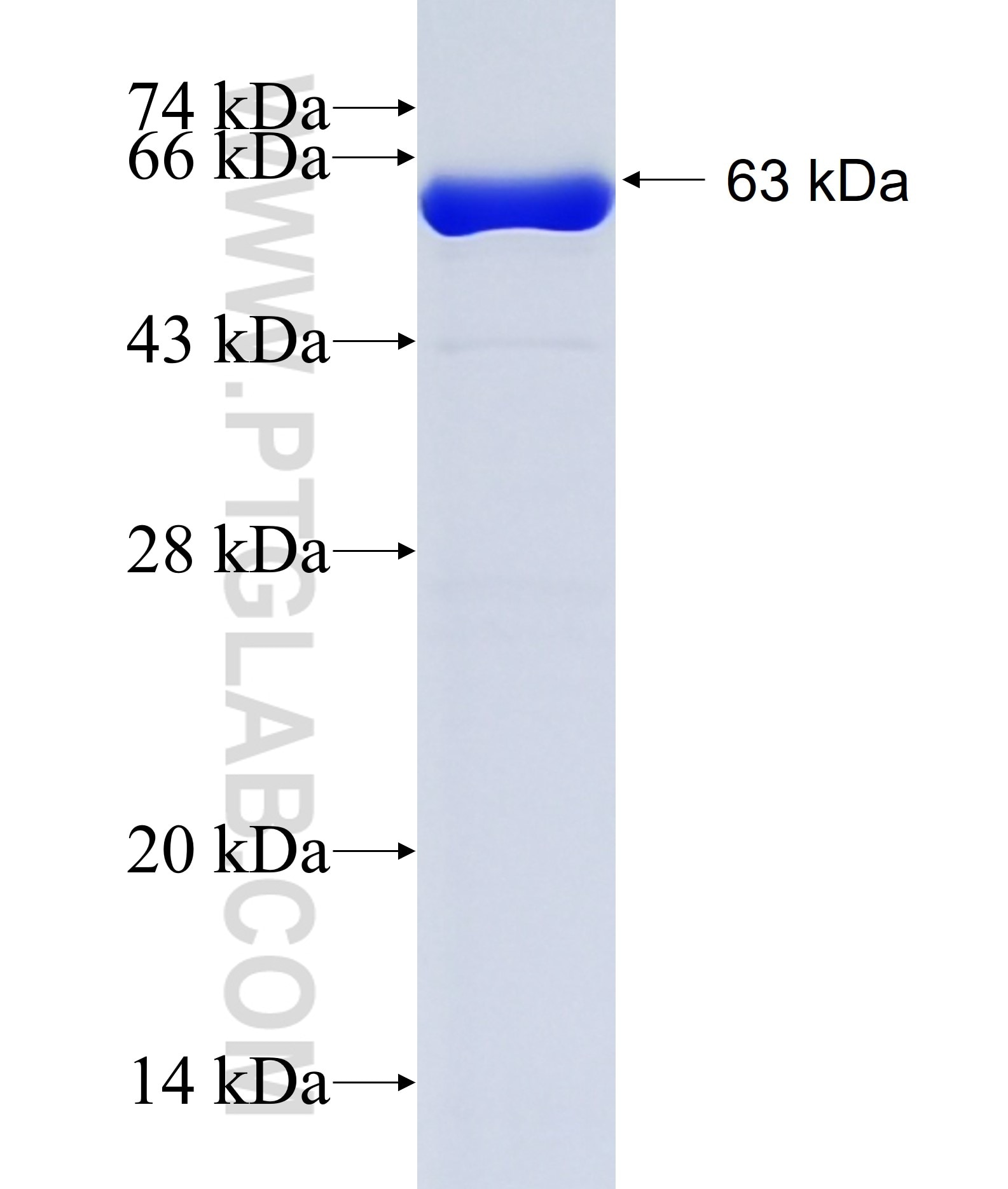 NOL11 fusion protein Ag11783 SDS-PAGE