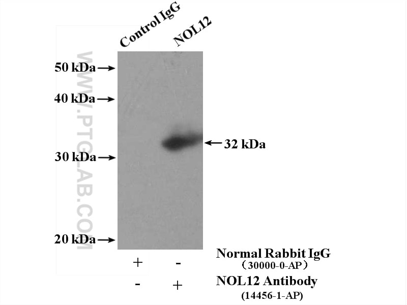 Immunoprecipitation (IP) experiment of HeLa cells using NOL12 Polyclonal antibody (15456-1-AP)