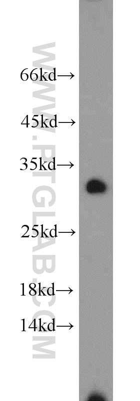 Western Blot (WB) analysis of HeLa cells using NOL12 Polyclonal antibody (15456-1-AP)
