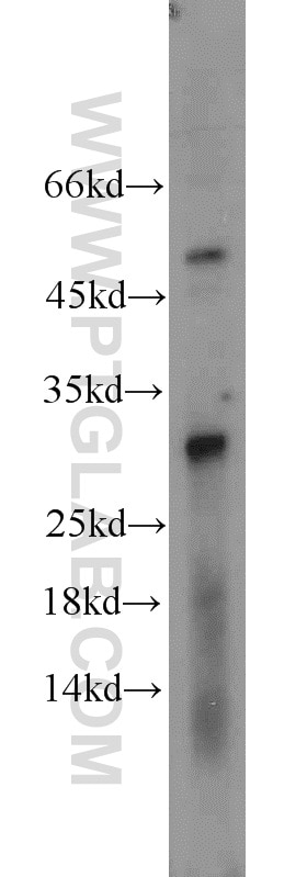 Western Blot (WB) analysis of SH-SY5Y cells using NOL12 Polyclonal antibody (15456-1-AP)