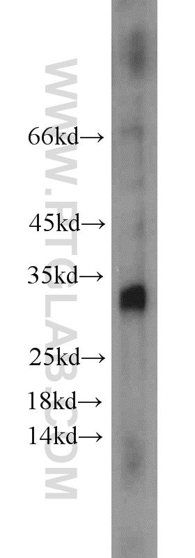 Western Blot (WB) analysis of HepG2 cells using NOL12 Polyclonal antibody (15456-1-AP)