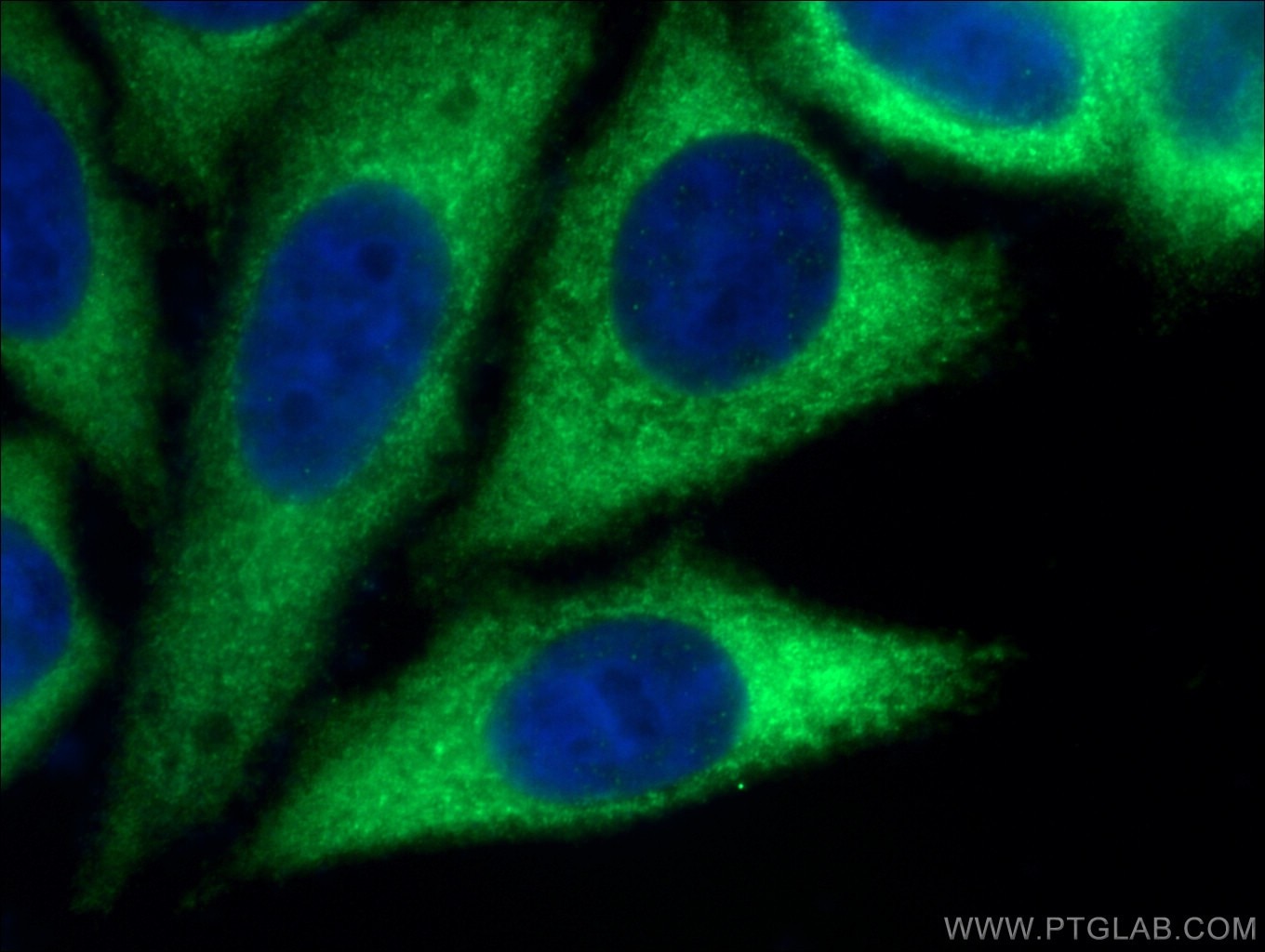 IF Staining of HepG2 using 10846-2-AP