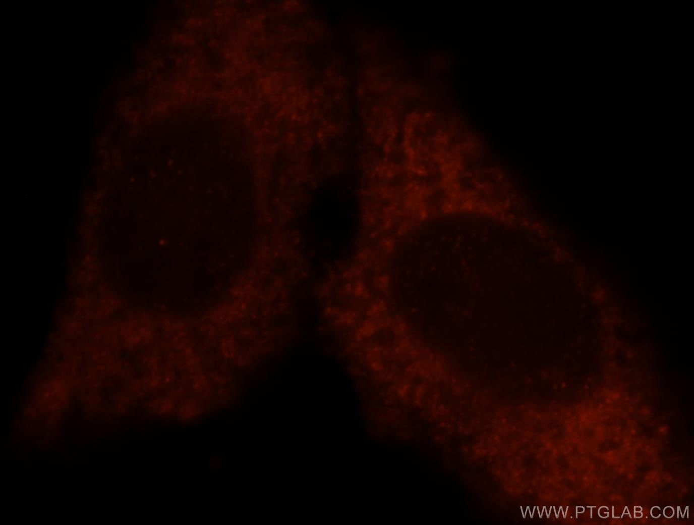 Immunofluorescence (IF) / fluorescent staining of HepG2 cells using NOL3 Polyclonal antibody (10846-2-AP)