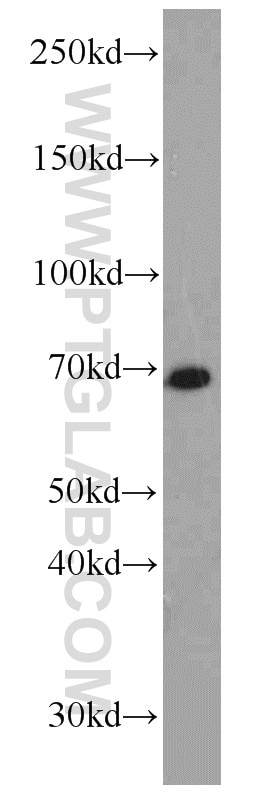 Western Blot (WB) analysis of mouse brain tissue using NOL4 Polyclonal antibody (14802-1-AP)