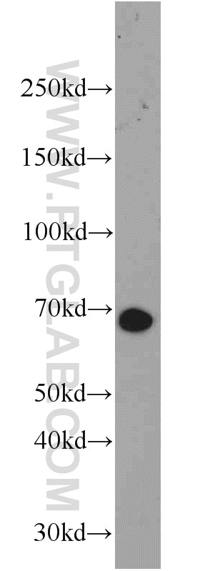 Western Blot (WB) analysis of mouse testis tissue using NOL4 Polyclonal antibody (14802-1-AP)
