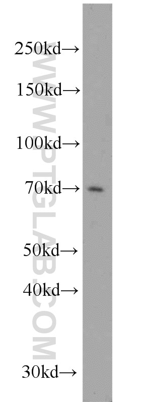 Western Blot (WB) analysis of rat brain tissue using NOL4 Polyclonal antibody (14802-1-AP)