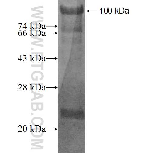 NOL4 fusion protein Ag6518 SDS-PAGE