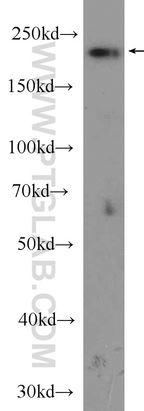 Western Blot (WB) analysis of HeLa cells using NOL6 Polyclonal antibody (15706-1-AP)